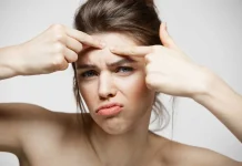 ¿Qué Alimento es Bueno para Quitar el Acné? La Guía Definitiva