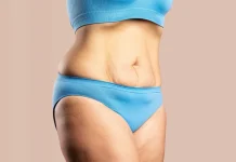 Cómo Endurecer el Cuerpo Después de Bajar de Peso: La Guía Definitiva Cómo Endurecer el Cuerpo Después de Bajar de Peso: La Guía Definitiva