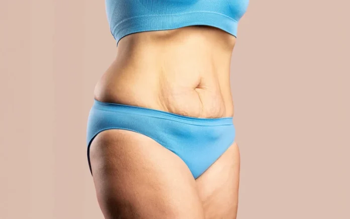 Cómo Endurecer el Cuerpo Después de Bajar de Peso: La Guía Definitiva Cómo Endurecer el Cuerpo Después de Bajar de Peso: La Guía Definitiva